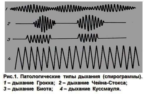 Как измерить частоту дыхания в домашних условиях?