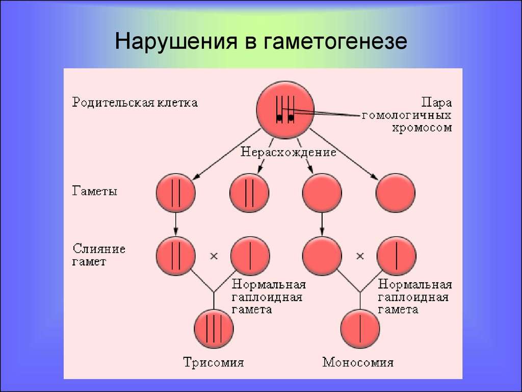 Синдром Лежена: провоцирующие факторы