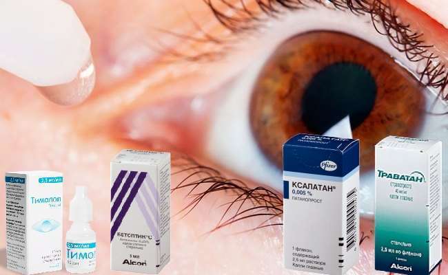 Как снизить давление глаза препаратами?