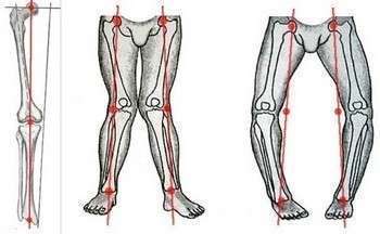 Это суставы, которые «вывернуло» от артроза. Фото с сайта  http://medicmagazin.ru/