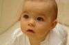 Фото ребенка с синдромом дауна в утробе