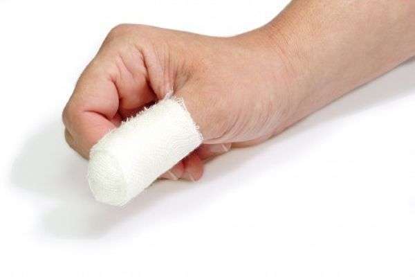 Как лечить ушиб пальца