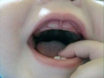 У ребенка режутся зубки: как понять и помочь. Фото с сайта www.genapa.ru