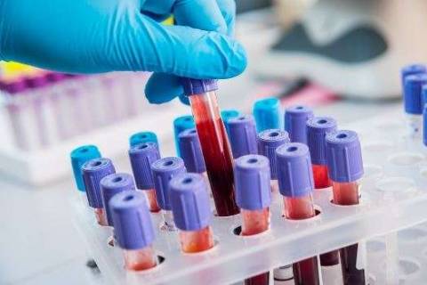 Биохимический анализ крови: почему АСаТ и АЛаТ понижен?