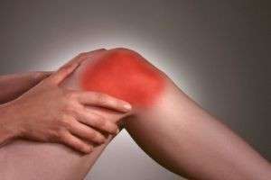 Коварный артроз коленного сустава — симптомы, которые проявляются на ранних и поздних стадиях
