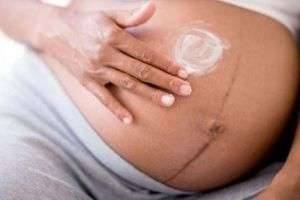Как избавиться от пигментных пятен при беременности и после родов?