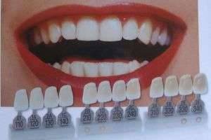 Протезирование зубов: виды и особенности