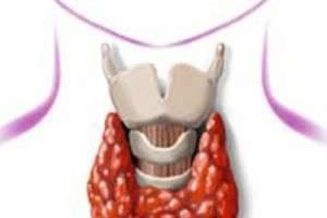Что такое гиперфункция щитовидной железы?