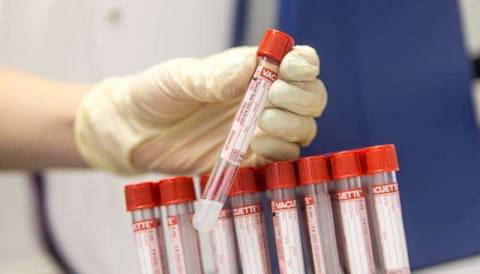 Что показывает анализ крови на онкомаркеры?