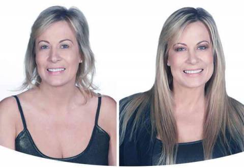 Применение никотиновой кислоты для роста волос: до и после